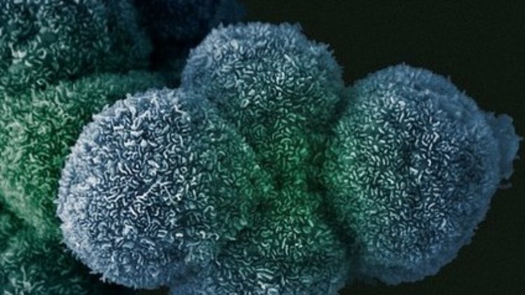 Kanser artık aldatamayacak