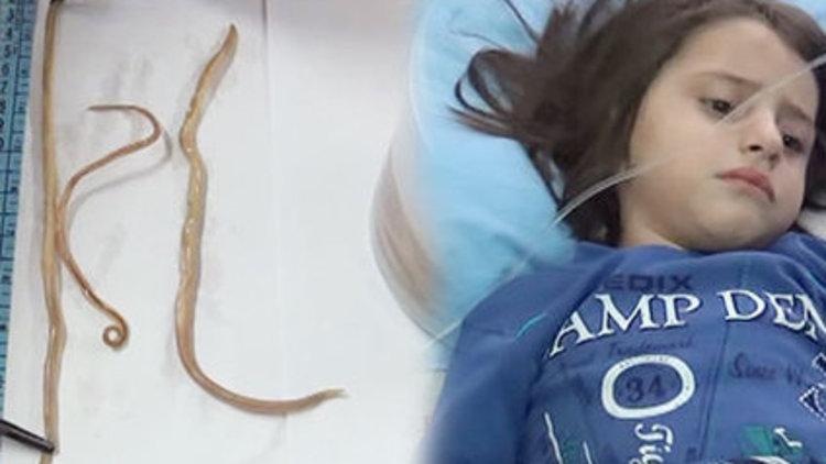 KARIN AĞRISI DEYİP GEÇMEYİN