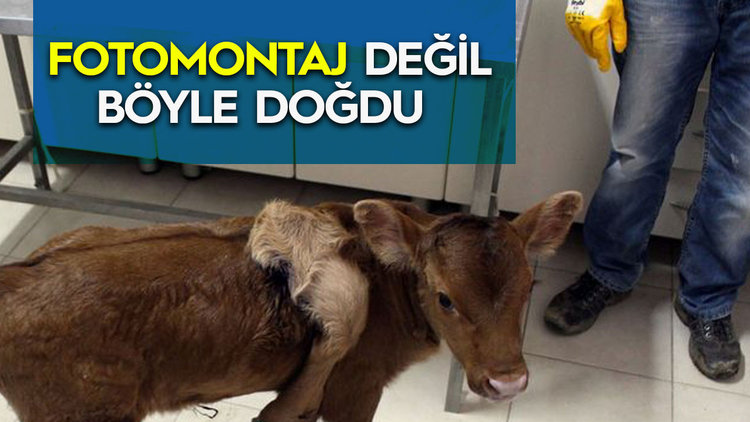 AMELİYATLA KURTULDU