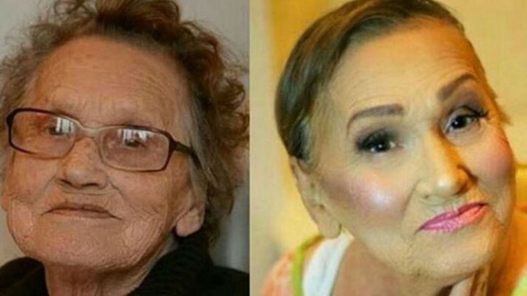 20 YAŞ GENÇLEŞTİ