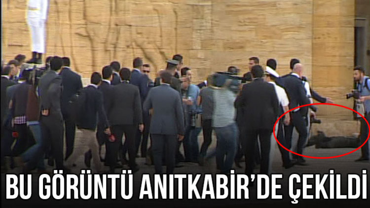 TANSİYONU DÜŞMÜŞ