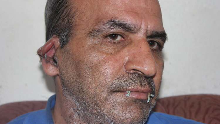 Birleşmiş Milletler'i protesto için ağzıyla kulaklarını dikti