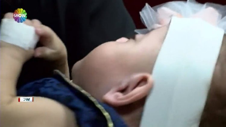 380 gram doğdu, 4 kilo 720 gram oldu!