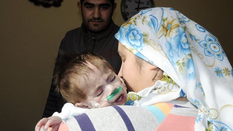 Kalp hastası minik Abdulkadir yardım bekliyor