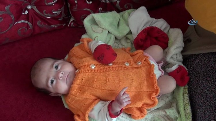 "Kelebek" hastası kardeşler yardım bekliyor