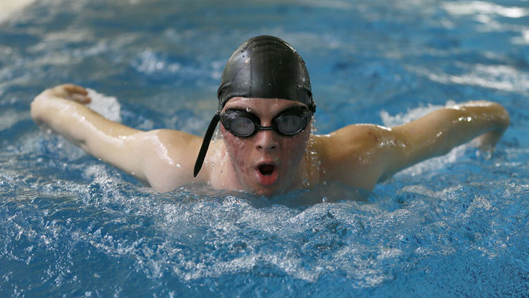 Down sendromlu şampiyon