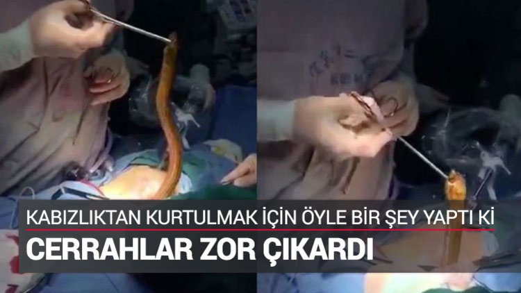 İçinden yılan çıkardılar