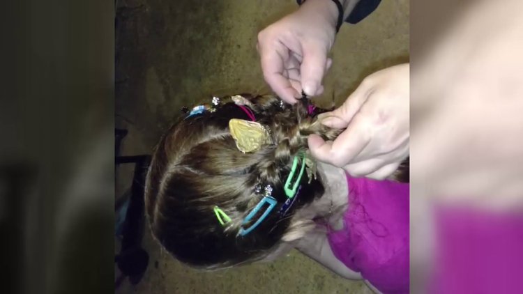 Ailesi küçük kızın saçından kertenkele çıkardı!