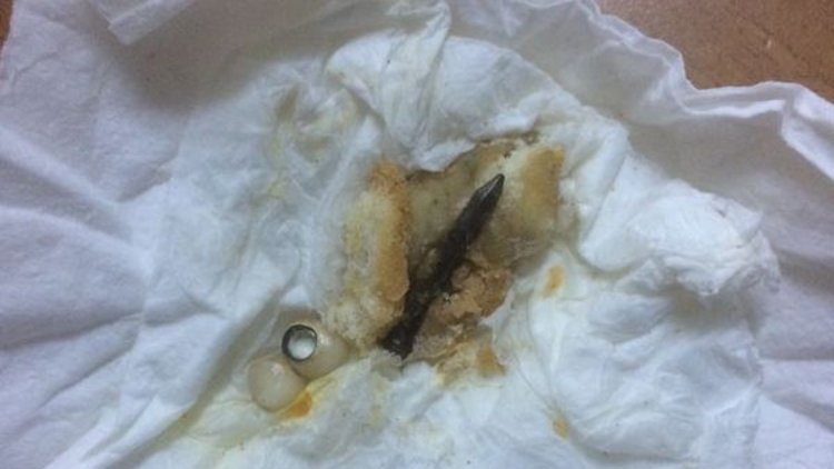 Pideden çivi çıktı, dişi kırıldı