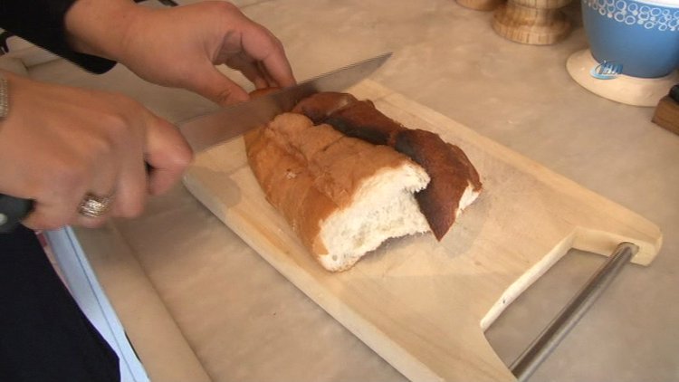 Pideden çıkan çivi 4 dişini kırdı