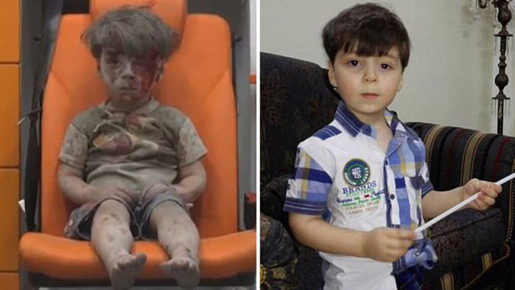 Ümran bebeğin son hali