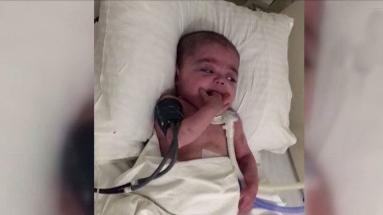 İkizler 4 yıldır ayrı...