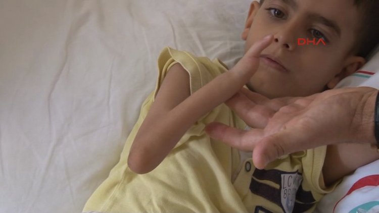 Bir parmak nakledildi hayatı değişti