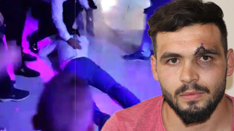 &#039;Şov yapayım&#039; derken... 