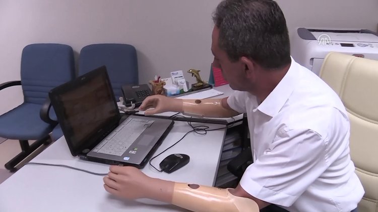 "Elektronik protez" yaşama sevinci oldu