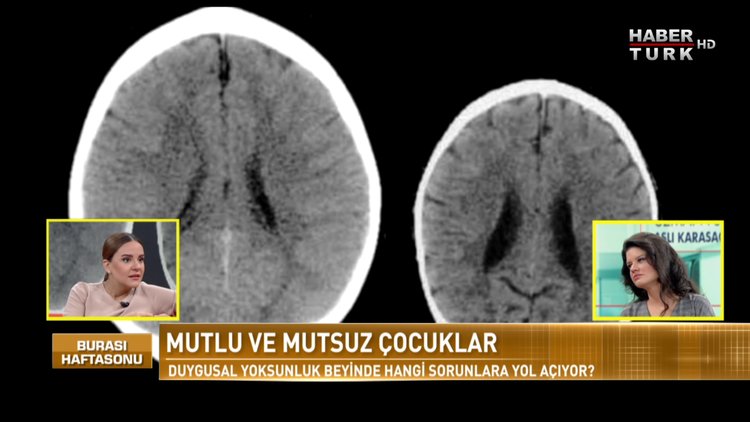 Burası Haftasonu - 5 Kasım 2017 (Aslı Karasaç Özkaya)