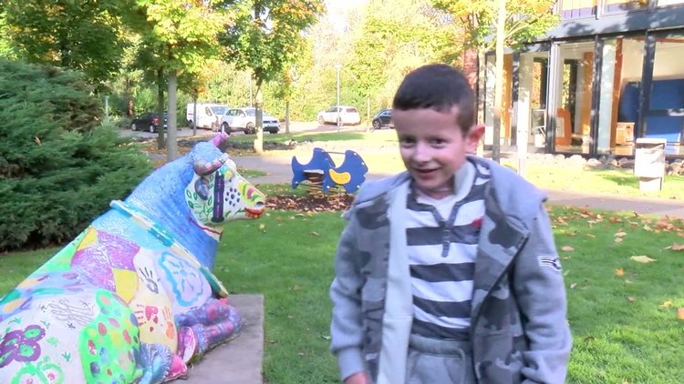 'Kelebek çocuk' deneysel gen tedavisiyle kurtuldu