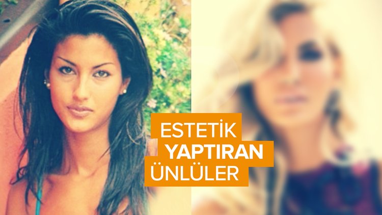 Estetik güzeli ünlüler