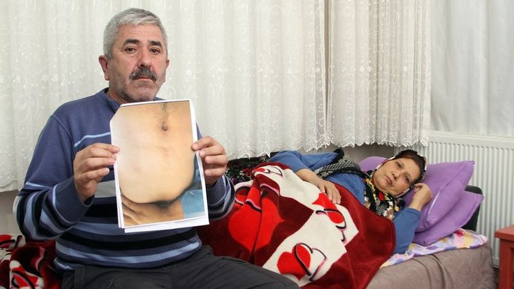 Isparta'da 8 yıldır karaciğer nakli bekleyen siroz hastası kadın