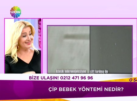Cip Bebek Nedir