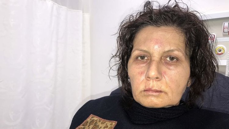 Park yüzünden hastanelik oldu