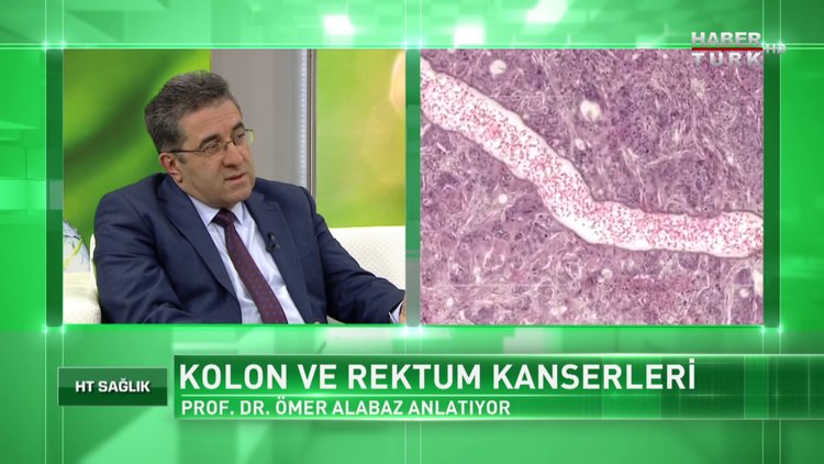 HT Sağlık - 27 Ocak 2018 (Kolon ve Rektum Kanserleri)