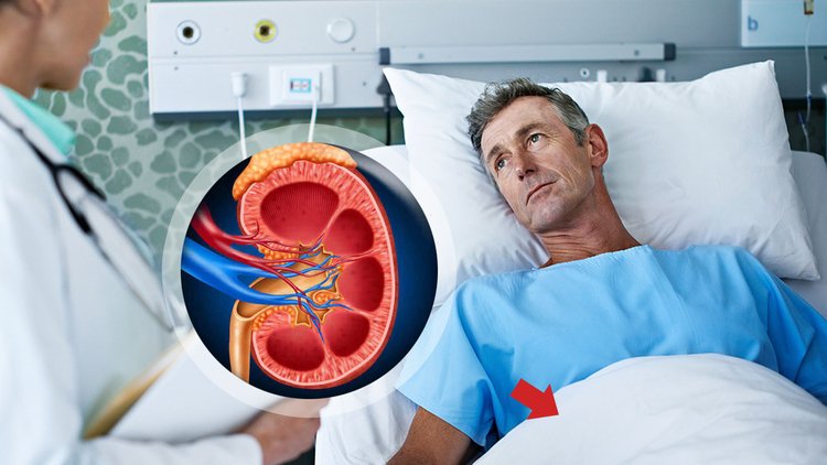 Neden Böbrek taşı oluşur, belirtileri nelerdir?