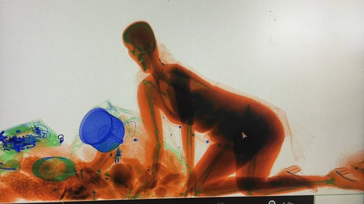 Parasını çaldırmaktan korktu, X-Ray cihazına daldı