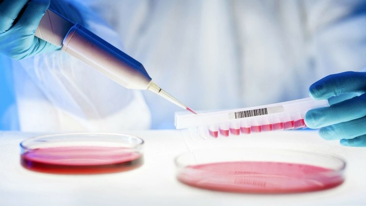 Kanser tedavisinde yeni umut: Likit biyopsi