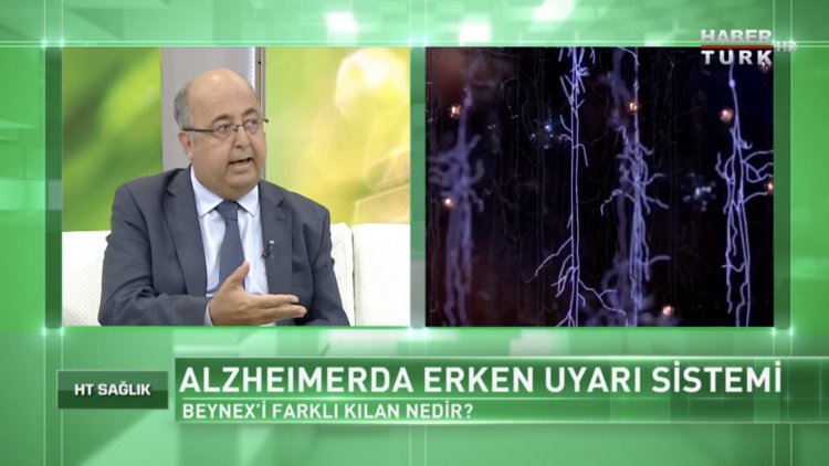 Beynex nedir?