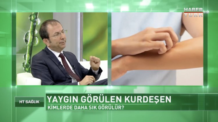 Kurdeşen kimlerde daha sık görülür?