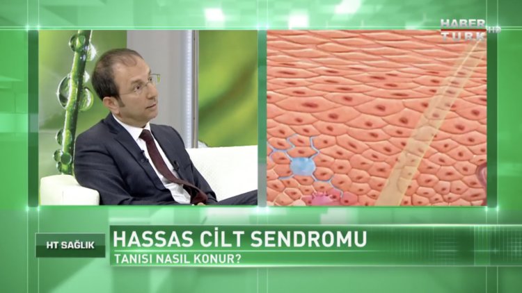 Hassas cilt sendromunun ana nedeni