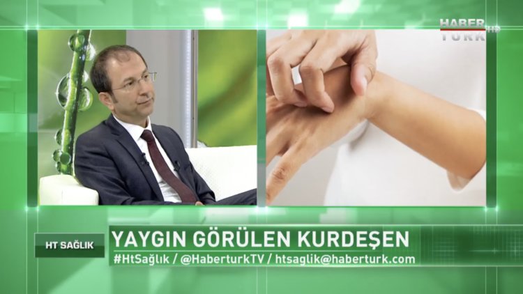 Kurdeşen tedavisinden anlamamız gereken nedir?