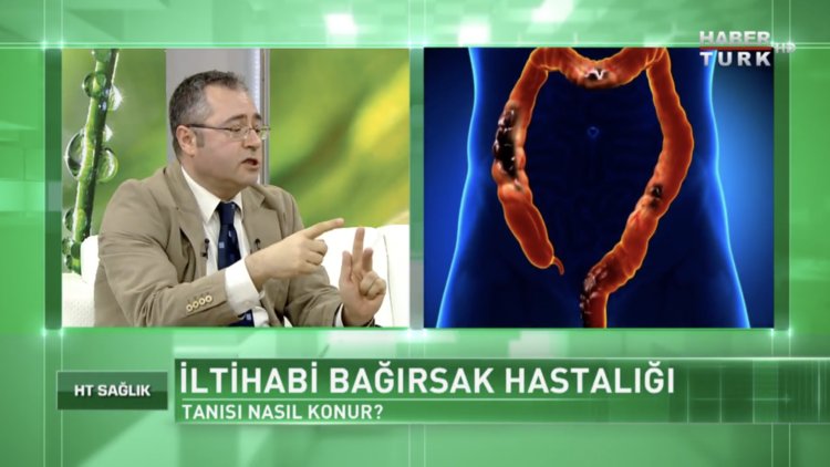 İltihabi bağırsak hastalığında tanı nasıl konulur?