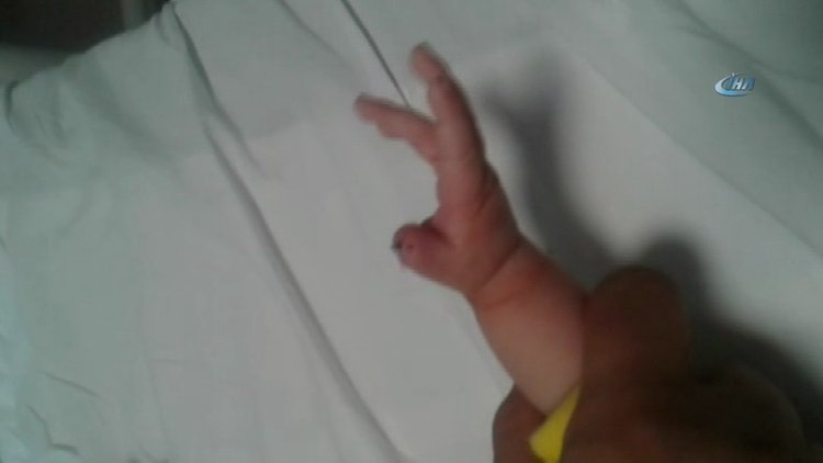 Sağlık personeli 1,5 aylık bebeğin parmağını kesti