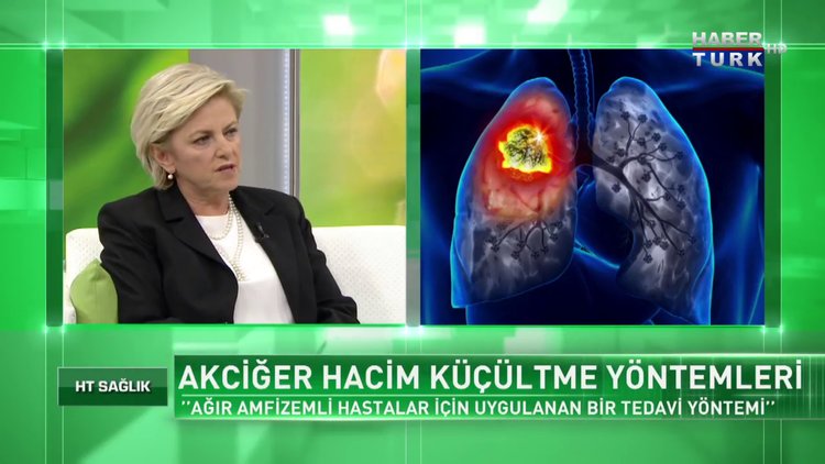 Akciğer hacim küçültme operasyonu herkese uygulanabilir mi?