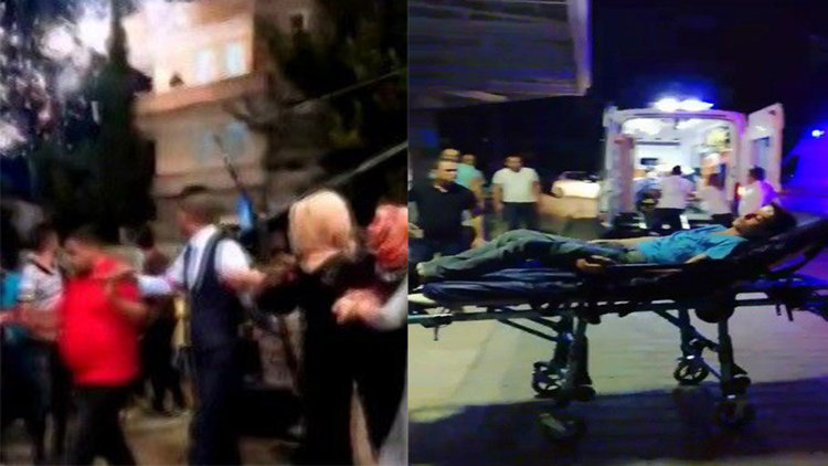 Düğünde dehşet! Havai fişek elinde patladı