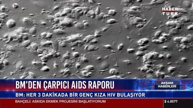 BM'den çarpıcı AIDS raporu