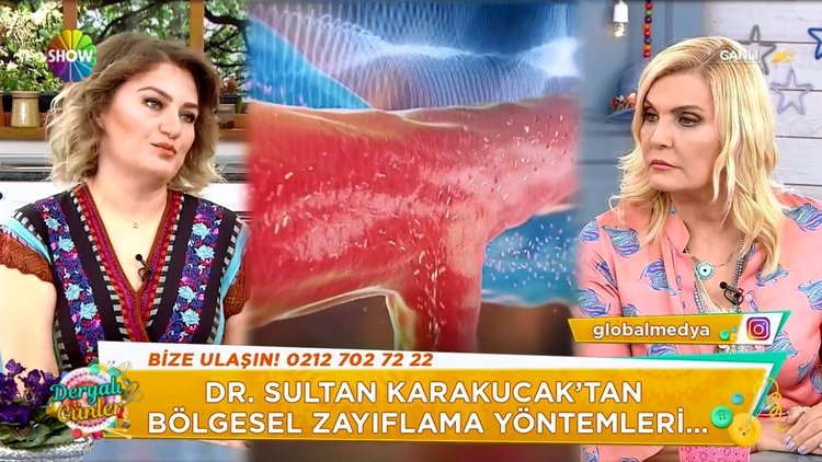 Lazer lipoliz yöntemi nedir?