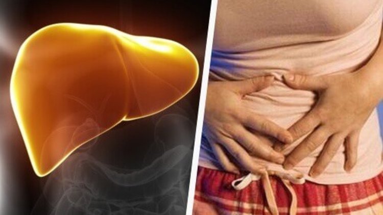 Karaciğer Yağlanması ve Tedavisi