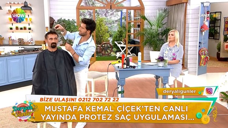 Protez saç uygulaması nedir?