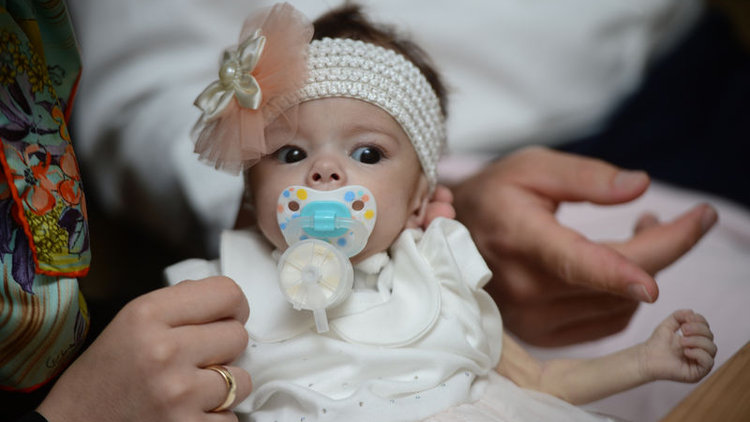 '100 gramlık' hayat! Gülsüm Sare tıp literatürüne geçti