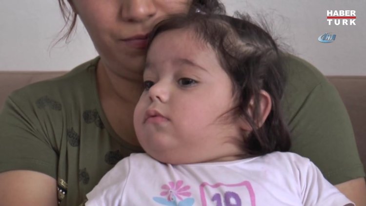 5 Ayrı hastalığın pençesindeki Minik Hiranur, yutkunursa ölecek