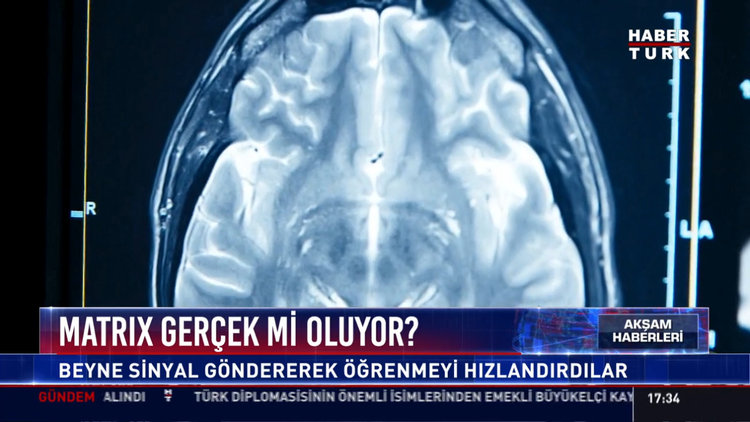 Matrix gerçek mi oluyor?