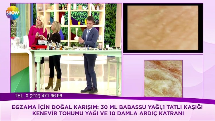 Egzama için doğal karışım