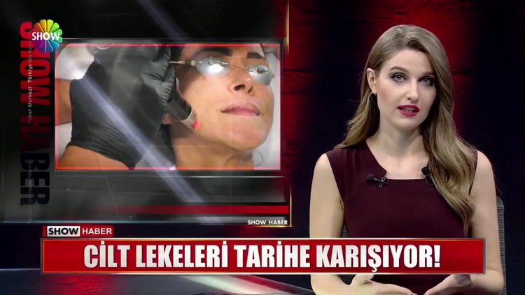 Kalıcı cilt lekelerine elveda
