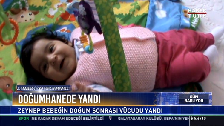 Doğumhanede yandı: Zeynep bebeğin doğum sonrası vücudu yandı