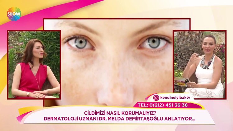 Cilt lekeleri nasıl tedavi edilir?