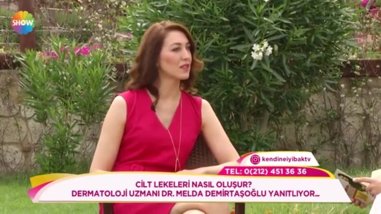 Cilt lekeleri nasıl oluşur?