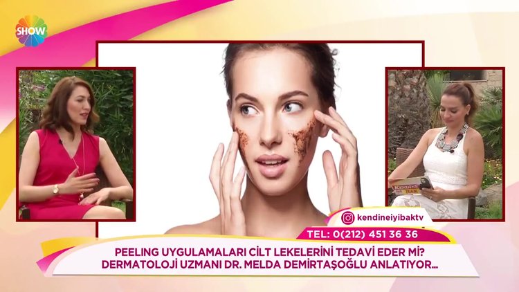 Peeling uygulamaları cilt lekelerini tedavi eder mi?